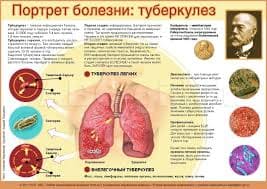 На фото описан портрет болезни туберкулеза